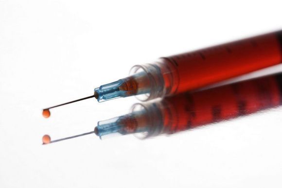 Kiekvienais metais mirtinomis injekcijomis Lietuvoje legaliai nužudoma tūkstančiai šunų ir kačių.