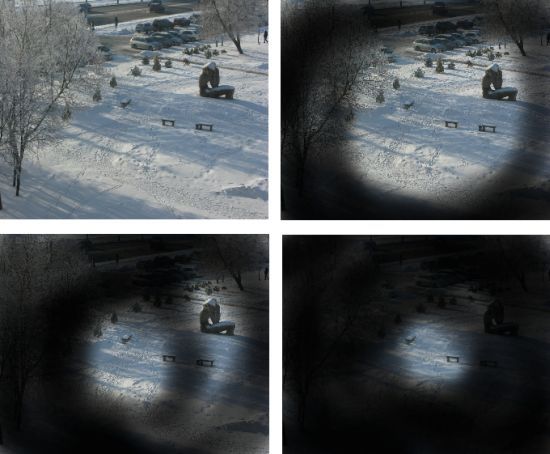 Glaukomos sukelti akių matomumo pakitimai