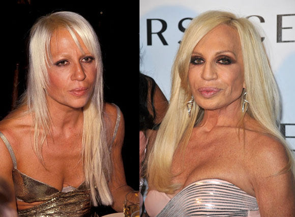 AOP ir Scanpix nuotr./Donatella Versace anksčiau ir dabar