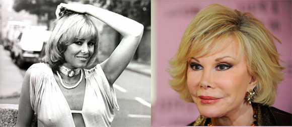 Scanpix nuotr./Joan Rivers anksčiau ir dabar