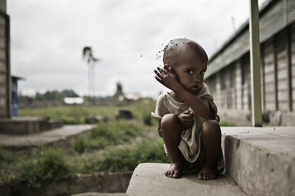 Prognozuojama, kad Nigeryje iš bado gali mirti 400 tūkst. vaikų