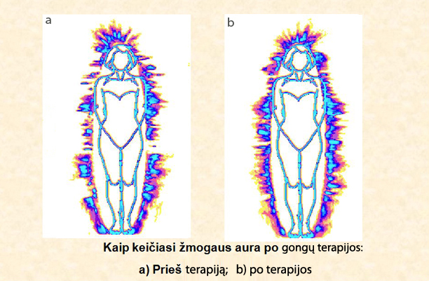 Artūro Dabkevičiaus nuotr./Žmogaus aura