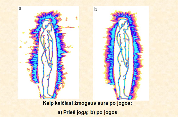 Artūro Dabkevičiaus nuotr./Žmogaus aura