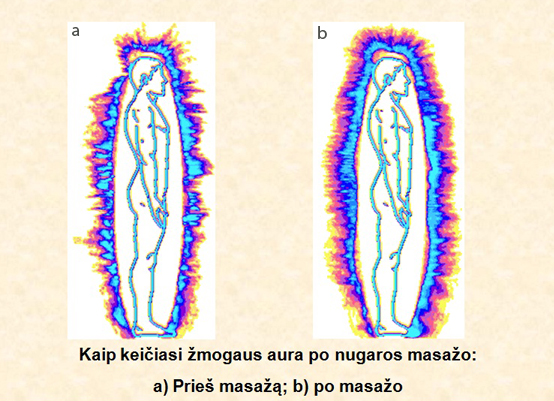 Artūro Dabkevičiaus nuotr./Žmogaus aura