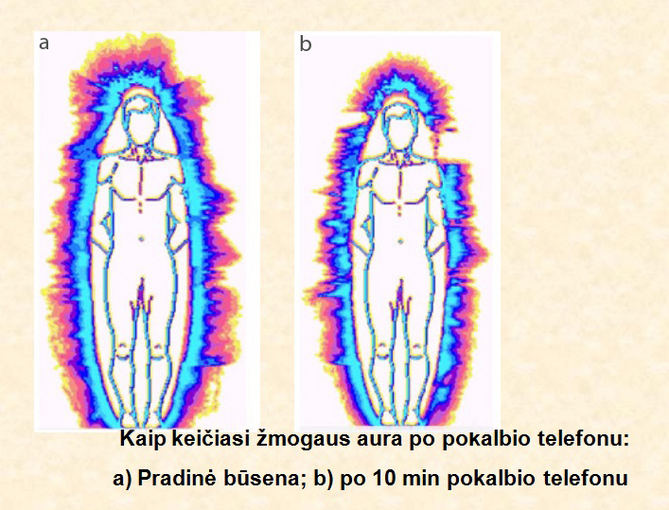 Artūro Dabkevičiaus nuotr./Žmogaus aura